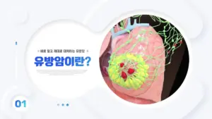 유방암 — KR news